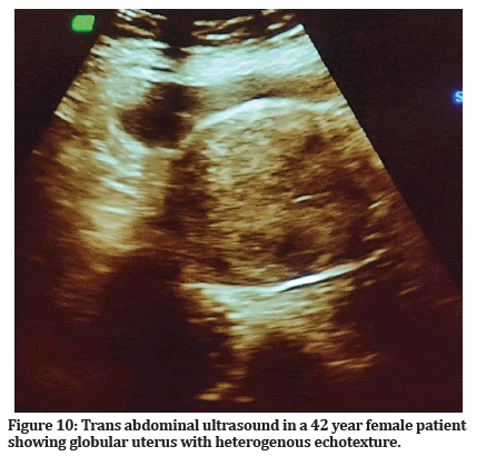 Medical-Dental-echotexture