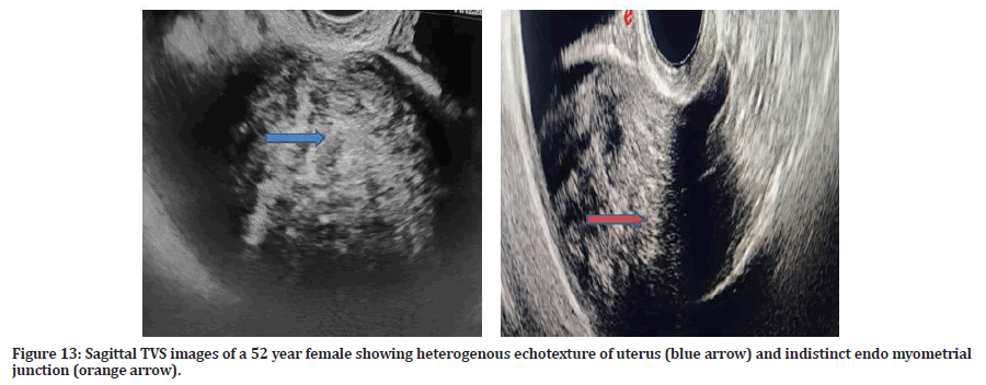 Medical-Dental-echotexture