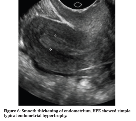 Medical-Dental-endometrial