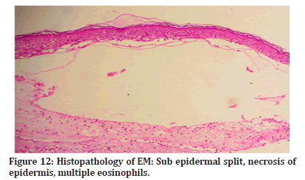 Medical-Dental-epidermal