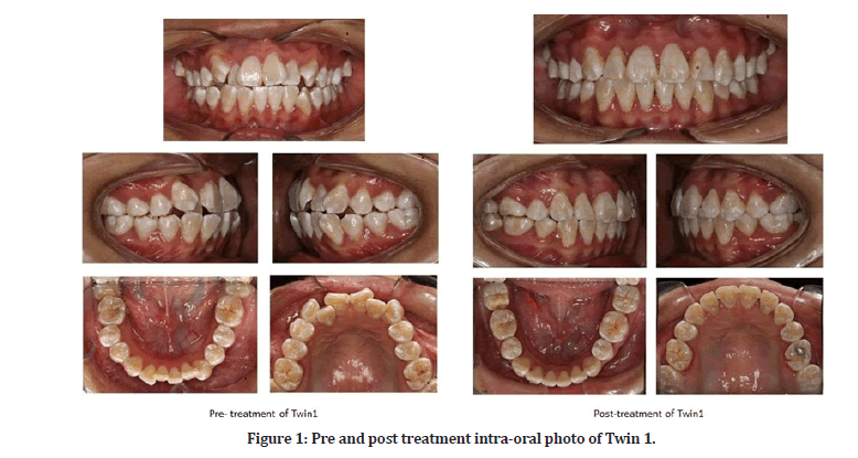 Medical-Dental-intra