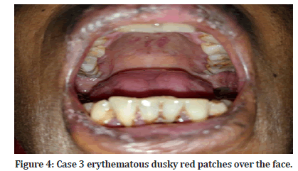 Medical-Dental-patches
