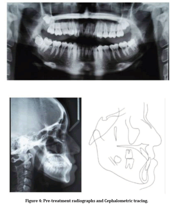medical-dental-Cephalometric