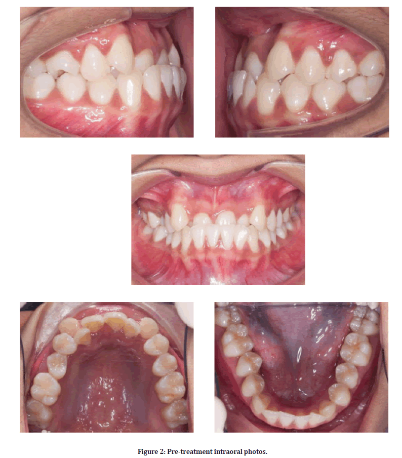 medical-dental-intraoral