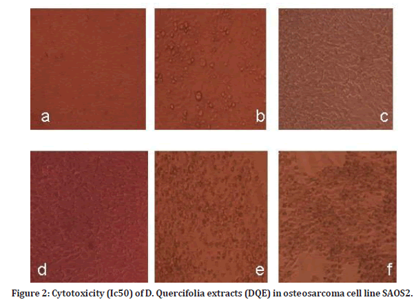 medical-dental-science-osteosarcoma-cell