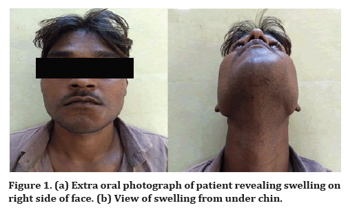 medical-dental-science-patient-revealing-swelling