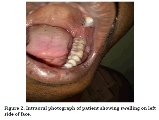 medical-dental-science-patient-revealing-swelling