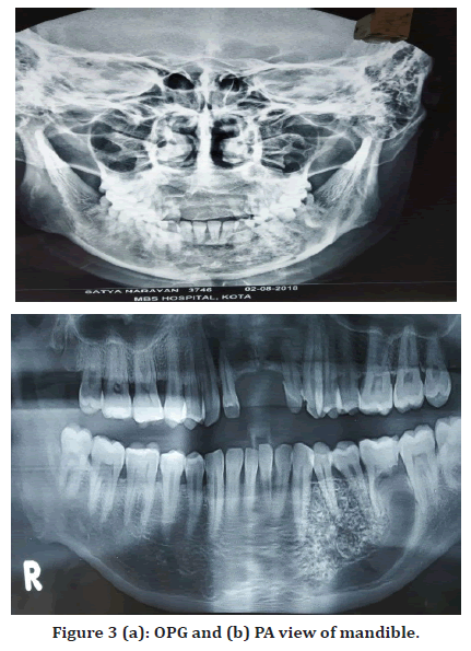 medical-dental-science-patient-revealing-swelling