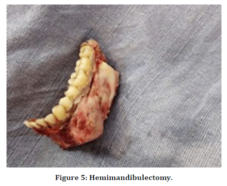 medical-dental-science-patient-revealing-swelling