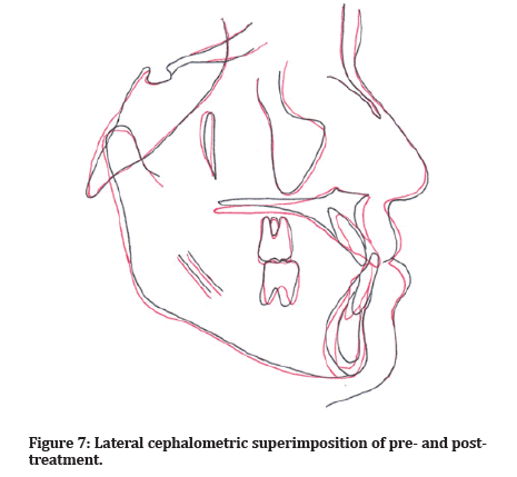 medical-dental-superimposition