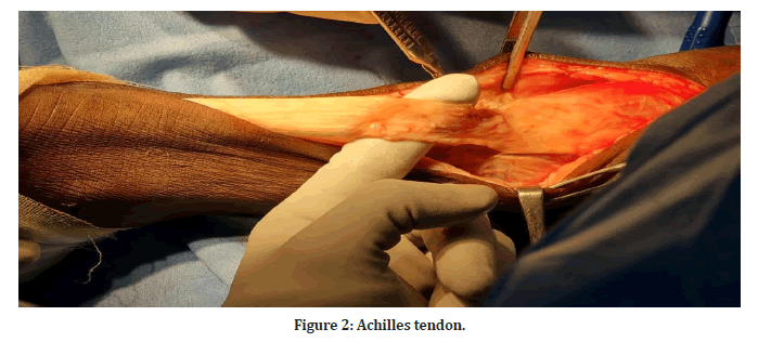 medical-dental-tendon