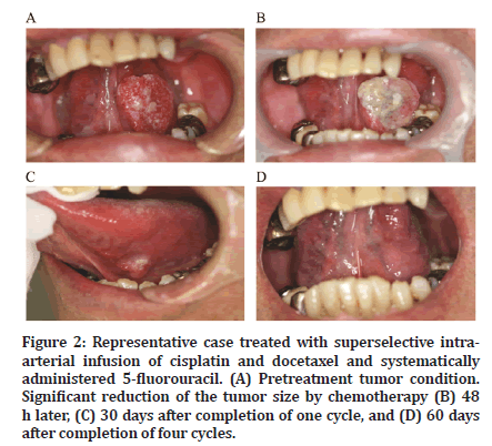 medical-dental-tumor
