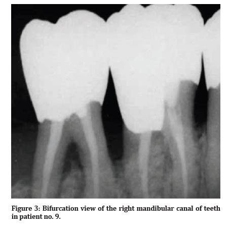 Medical-Dental-canal