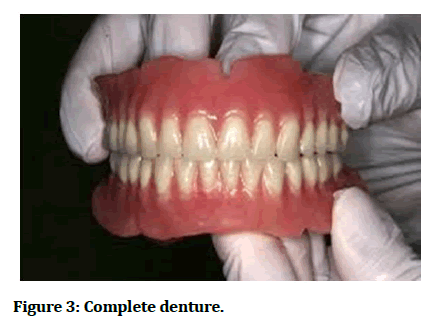 Medical-Dental-denture