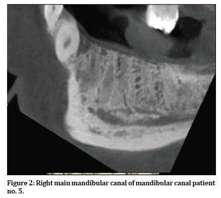 Medical-Dental-mandibular