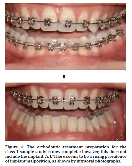 Medical-Dental-photographs