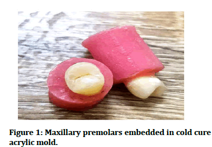 Medical-Dental-premolars