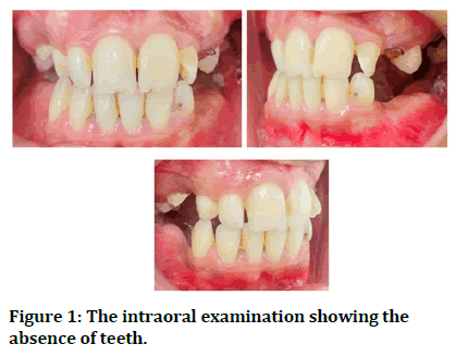 Research-Dental