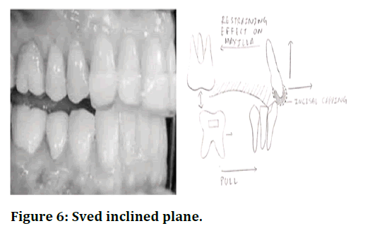 jrmds-Sved