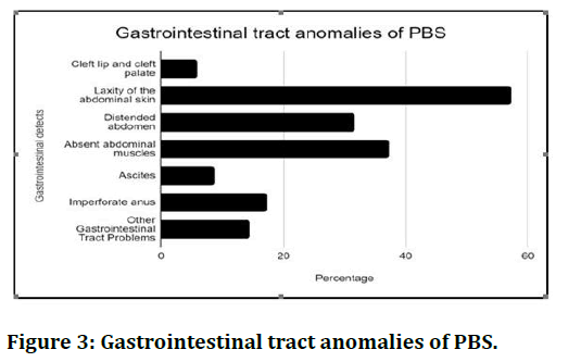 jrmds-anom