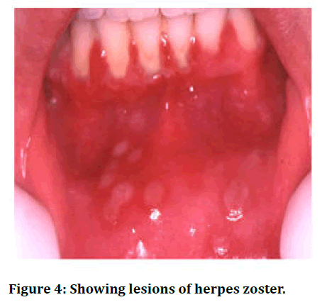 jrmds-lesions