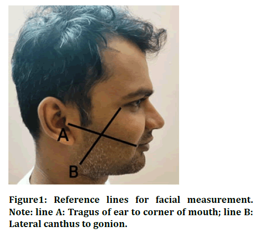 jrmds-lines jrmds-lines